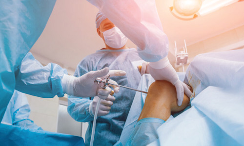 Arthroscopic Surgeries
