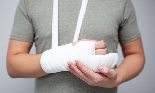 All type of Fracture